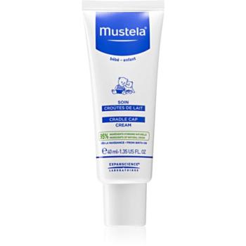 Mustela Bébé krém gyermekeknek a hajban lévő elhalt bőrre 40 ml kép